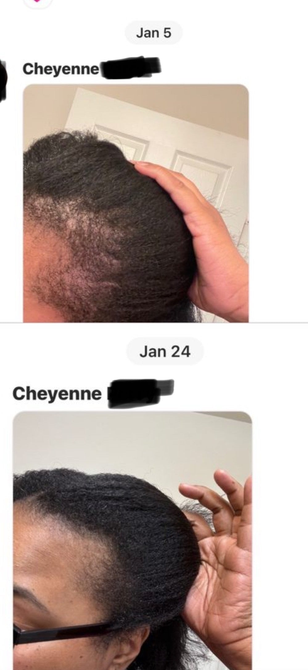 Bioactive Scalp Serum